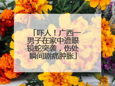 吓人！广西一男子在家中遭眼镜蛇突袭，伤处瞬间剧痛肿胀